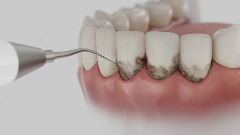 Trusted Dental Crowns And Bridges service in Weedpatch, CA - Dentist Open Now
